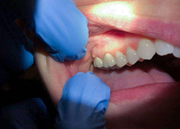Best Emergency TMJ Treatment in June Park, FL