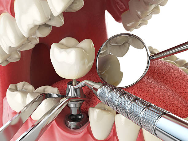 Best Cosmetic Emergency Dentistry in June Park, FL
